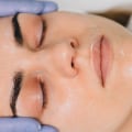 Where to Learn HydraFacial: A Guide to Certification and Education