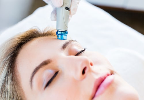 The Benefits of HydraFacial: Get Ready for a Rewarding Glow