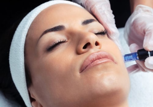 Which is Better: Hydrafacial or Microneedling?