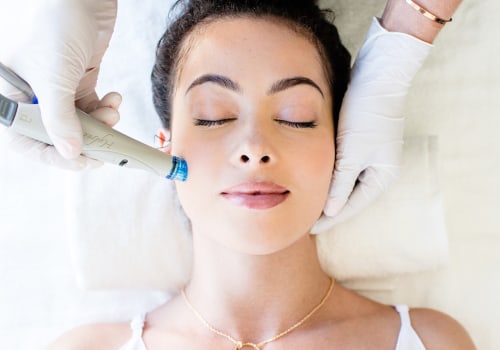 How to Get the Best Results from a HydraFacial Before a Special Event